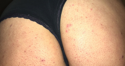 Cuide se Bem Exfoliante Corporal Pessegura– Suavidad y Frescura para Tu Piel