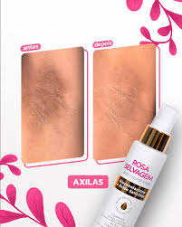 Ácido Clareador Rosa Selvagem 100ml