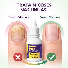 proteccion micosis uña cora