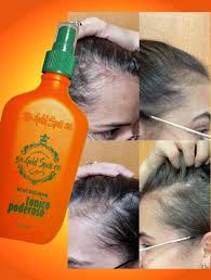 Tônico Laranja Poderoso (Tónico Naranja Poderoso): Tratamiento Avanzado para el Crecimiento del Cabello y Anticaída - 4.06 fl oz (120 ml)