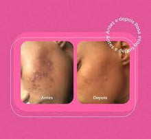 Rosa Selvagem Crema Corporal Iluminadora 100ml