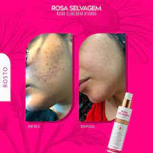 Ácido Clareador Rosa Selvagem 100ml