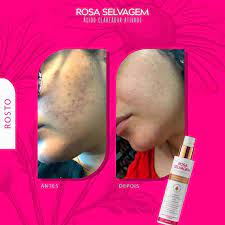 Ácido Clareador Rosa Selvagem 100ml