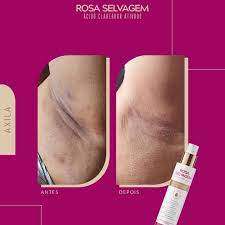 Ácido Clareador Rosa Selvagem 100ml