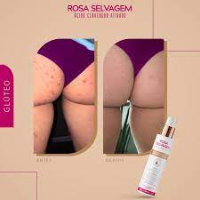 Ácido Clareador Rosa Selvagem 100ml